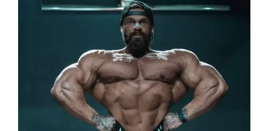 Mike Sommerfeld Weight Issue Ahead of Arnold Classic 2026